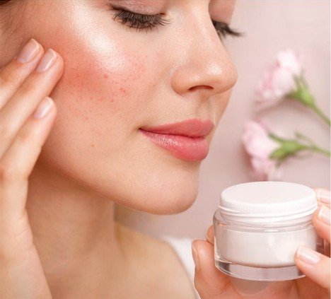 Sensitive and Reactive Skin